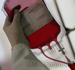 Вперше в світі пацієнтові перелили штучну кров