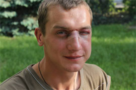 У столиці “антифашисти” жорстоко побили людину за те, що розмовляє українською