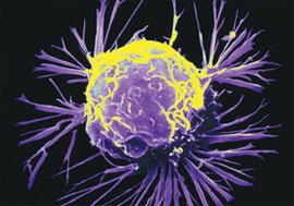 Вченим вдалося зрозуміти, як ракові клітини обманюють імунну систему