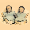 Неправильні близнючки Джудіт і Джойс Скотт: історія сестринської любові